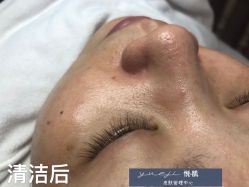 -悦肌YJ FOR FACE皮肤管理中心