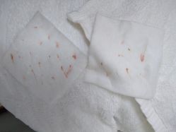 -痘博士北京·全国连锁祛痘机构