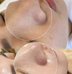 -Cream88颜皮肤管理中心