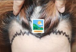 -大麦微针植发全国连锁