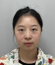 -天津健丽·去眼袋医疗美容机构