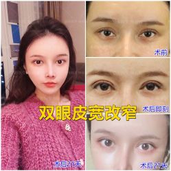 -丰联丽格医疗美容·联合丽格眼整形中心