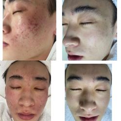 -Cream88颜皮肤管理中心