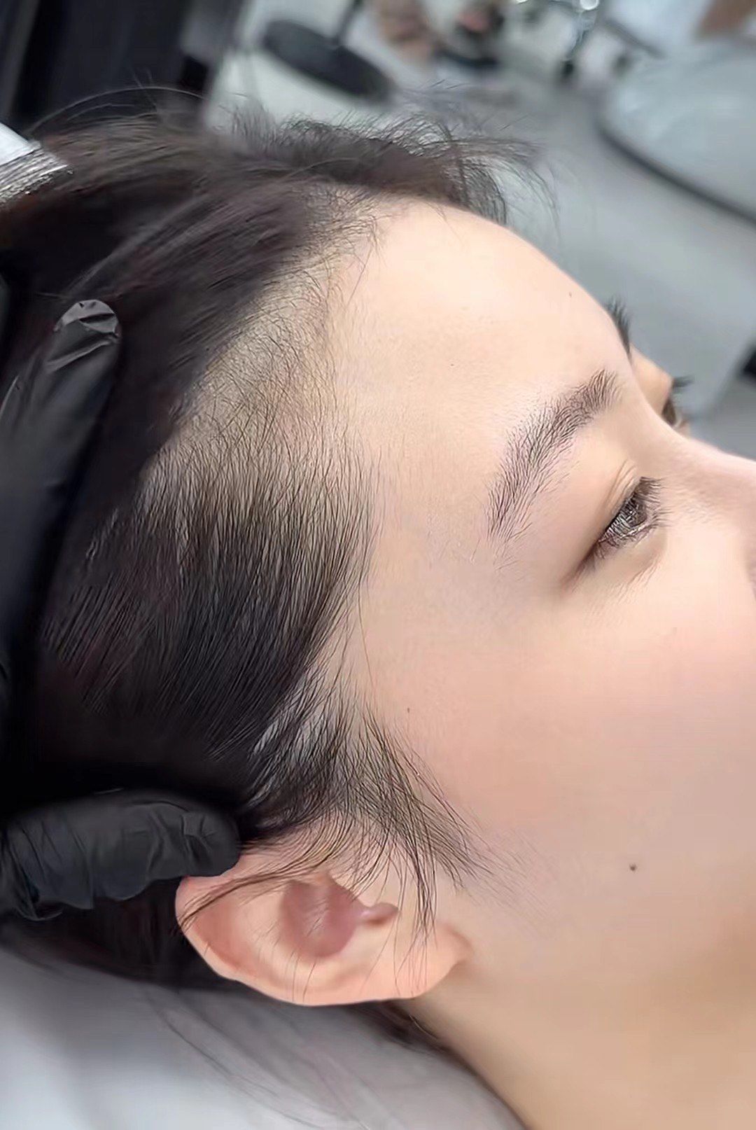 今日份发际线大作战