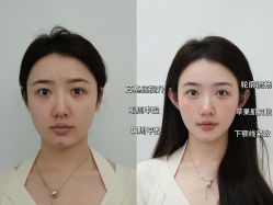 -素美医疗美容·西南眼鼻整形·修复基地