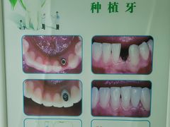 -杭州市第三人民医院