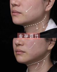 -LUNA皮相美·骨相美高级美感