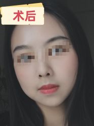 -素美医疗美容·西南眼鼻整形·修复基地