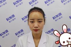 点击看大图 -大麦微针植发丨全国连锁