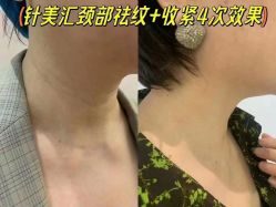 -LUNA皮相美·骨相美高级美感