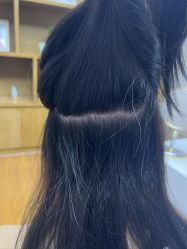 -大麦微针植发全国连锁