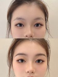 -美愈美肤MEIYU SKIN