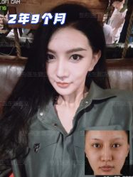 -北京米扬丽格医疗美容·联合丽格鼻整形中心