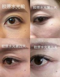 -Yestar艺星医疗美容医院