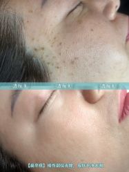 -清疣美疣·痣·斑净肤中心