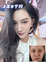 -北京米扬丽格医疗美容·联合丽格鼻整形中心