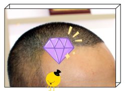 -大麦微针植发全国连锁