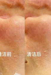 -SKIN79皮肤管理中心