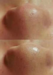 -苑苑vbeauty科技美容SPA