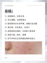 点击看大图 -玛莲朵·海菲秀冰珀科