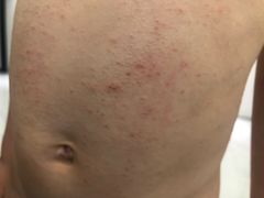 -春晖园度假酒店温泉