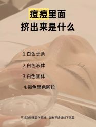 -克丽缇娜