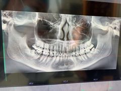 -同步齿科·数字化正畸种植口腔中心(珠海店)