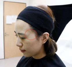 -Yestar 嘉兴艺星医疗美容医院