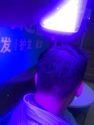 -碧莲盛·不剃发植发