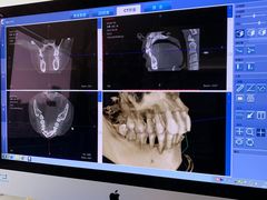 -Dr.Z dental仁康种植矫正中心