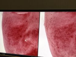 -韩国淼美颜皮肤管理官方直营店