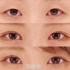 -上海漾颜医疗美容