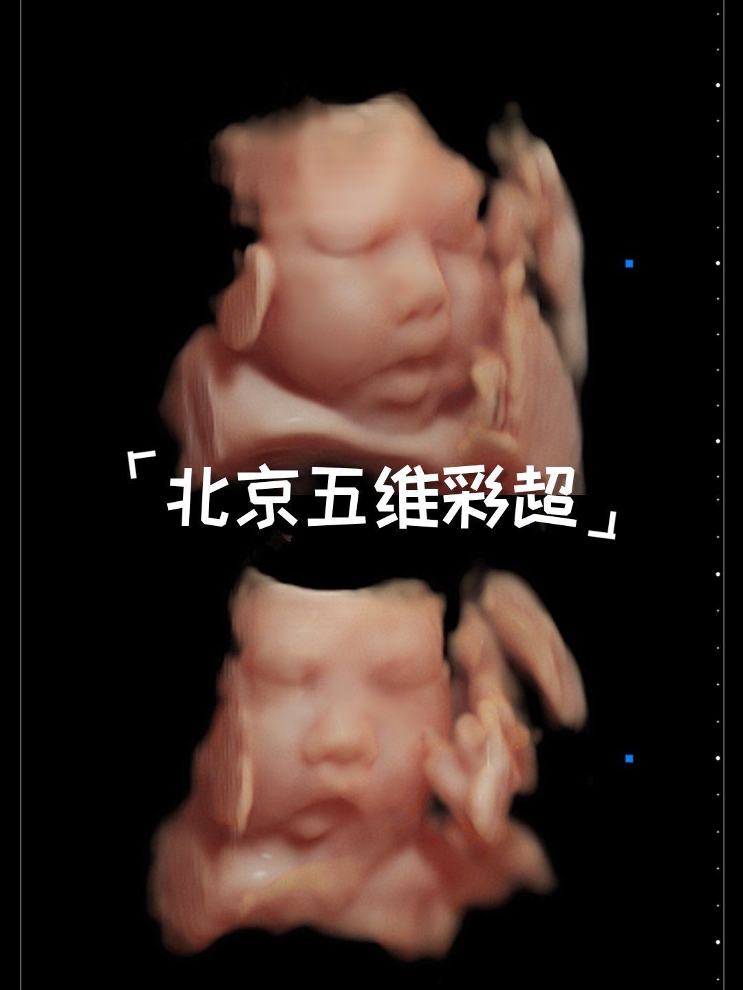 36周 ,小宝贝,已经五斤六两了