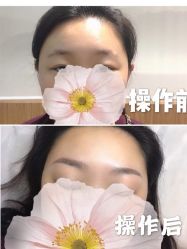 -久匠·纹眉纹绣半永久