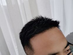 -雍禾植发全国连锁