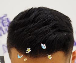 -大麦微针植发全国连锁