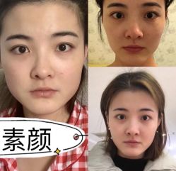 -圣嘉新医疗美容医院