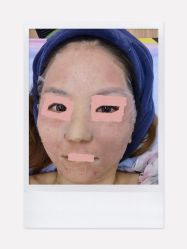 点击看大图 体验后-广州美莱医疗美容医院