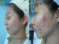 点击看大图 -瓷肌博士·祛痘科技美肤