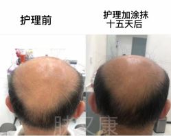 -天其美科学美肤·生发健康管理