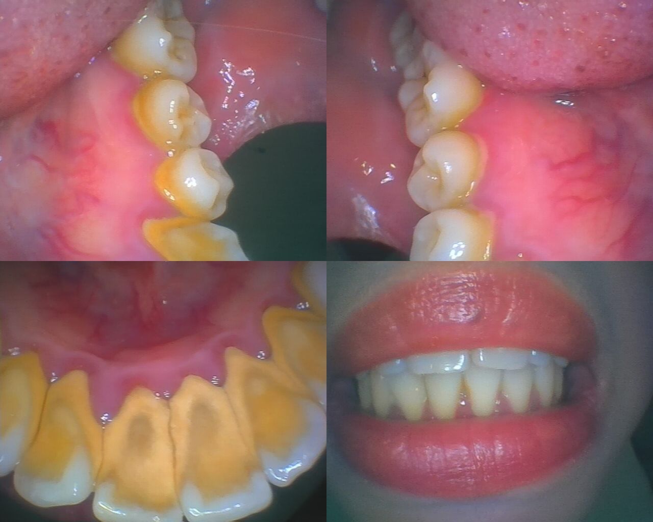 一次来洗牙还是有点紧张,毕竟这是我第一次正式来口腔医院看牙齿🦷