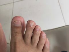 -新甲连锁灰指甲·甲沟炎·鸡眼(黑龙江路店)