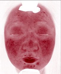 体验前-韩国淼美颜皮肤管理官方直营店