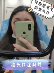 -伊丽莎白医疗美容