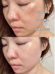 -慕颜医疗美容·皮肤微整 抗衰
