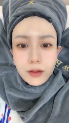 点击看大图 体验后-北京炫美医疗美容