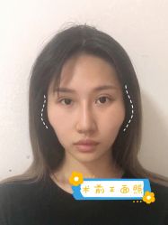 -长沙雅美医疗美容医院