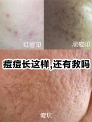 -Yestar艺星医疗美容医院