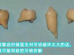 -团圆口腔·种植中心(锦江院区)