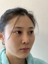 -北京米扬丽格医疗美容·联合丽格鼻整形中心